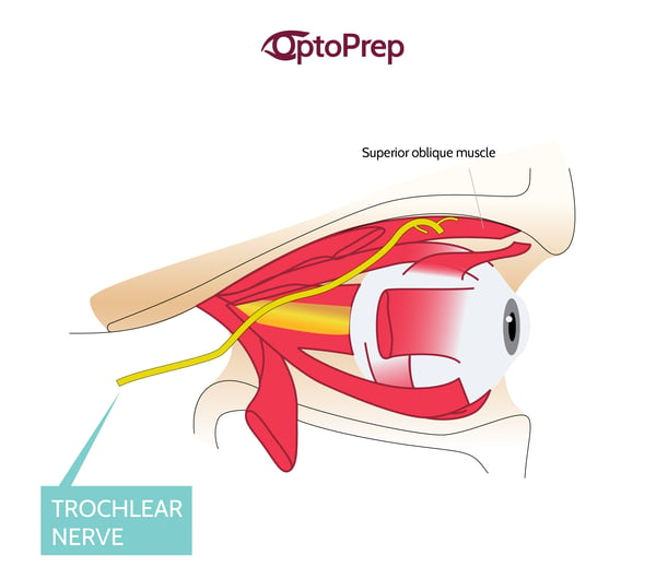 trochlear nerve function test